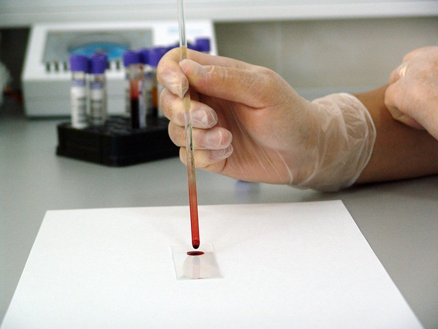 Rola testów serologicznych w diagnostyce alergii pokarmowych